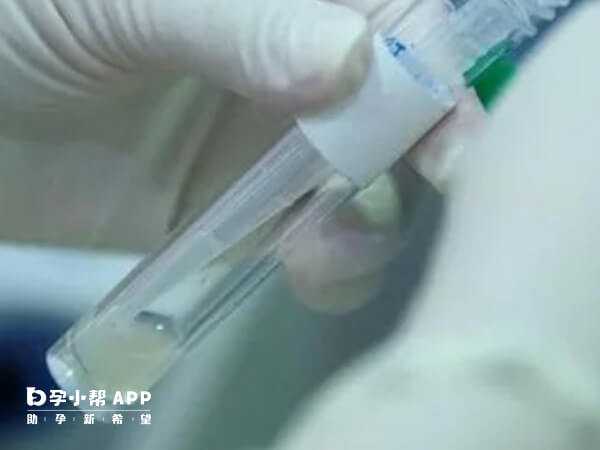 厦门妇幼供卵怎么申请？本地人就医流程与费用参考